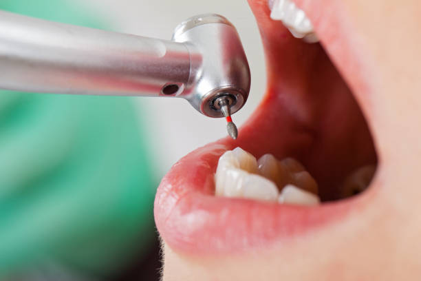 Best Emergency Treatment for Toothache in Grantsburg, WI